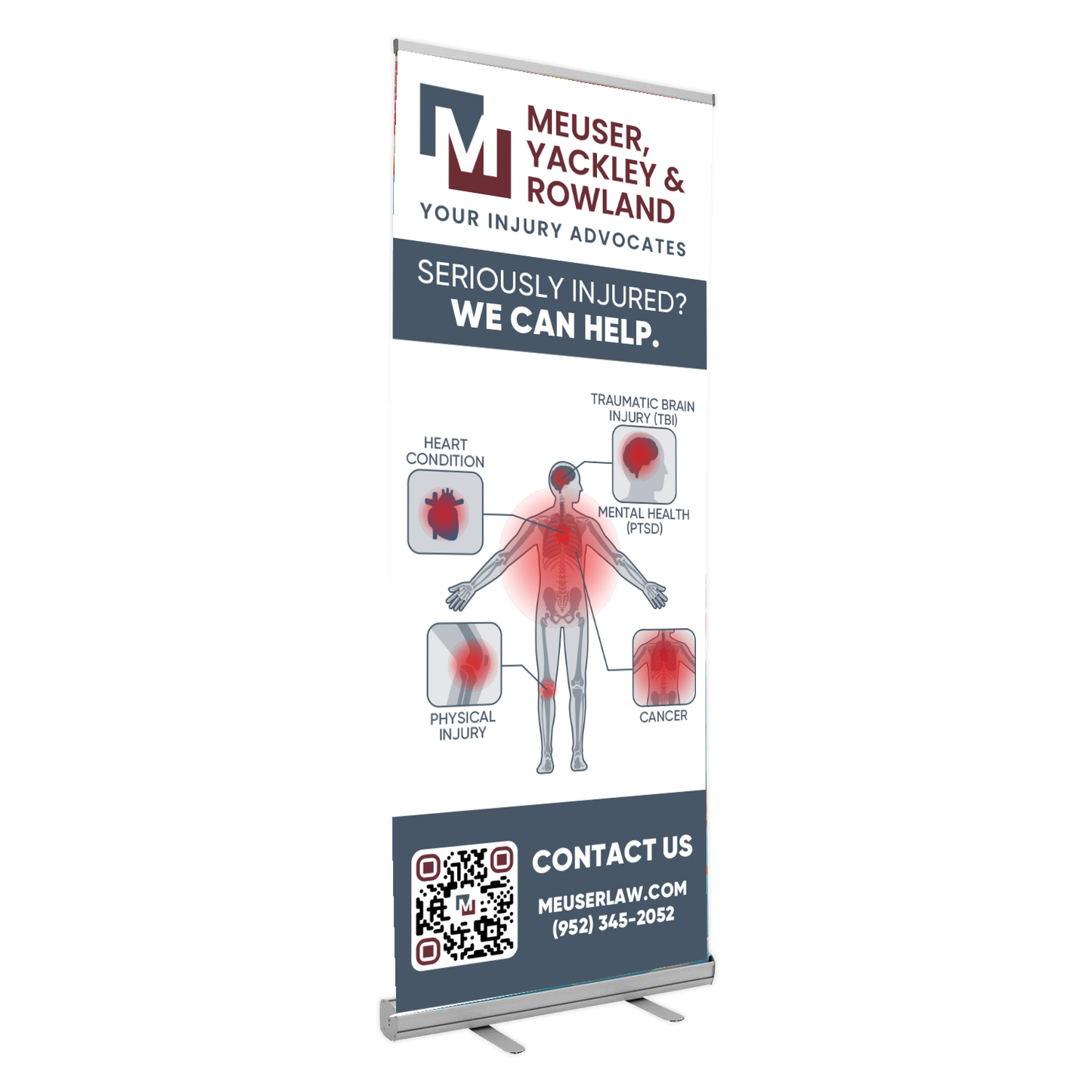 Meuser Law Fully Custom Banners