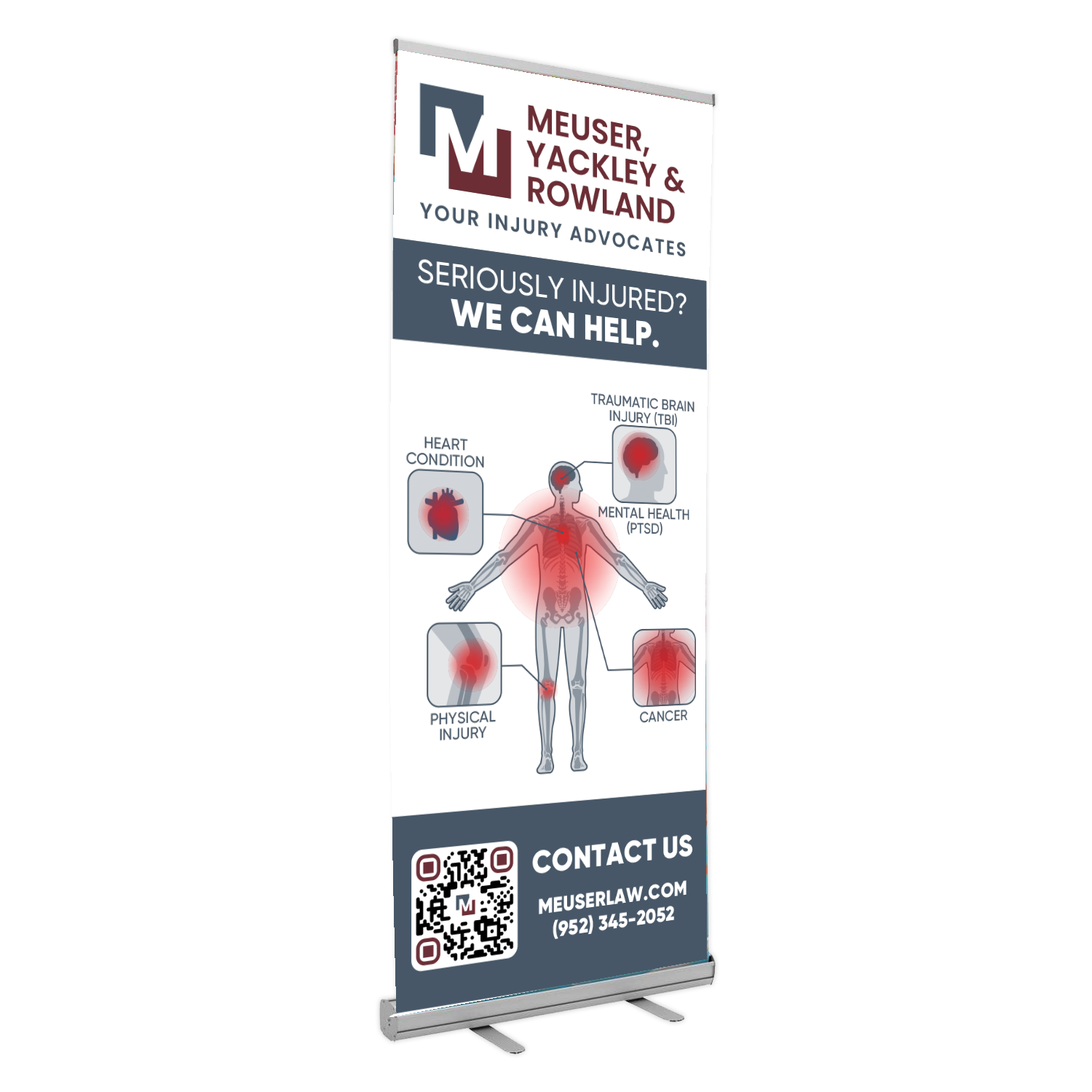 Meuser Law Fully Custom Banners